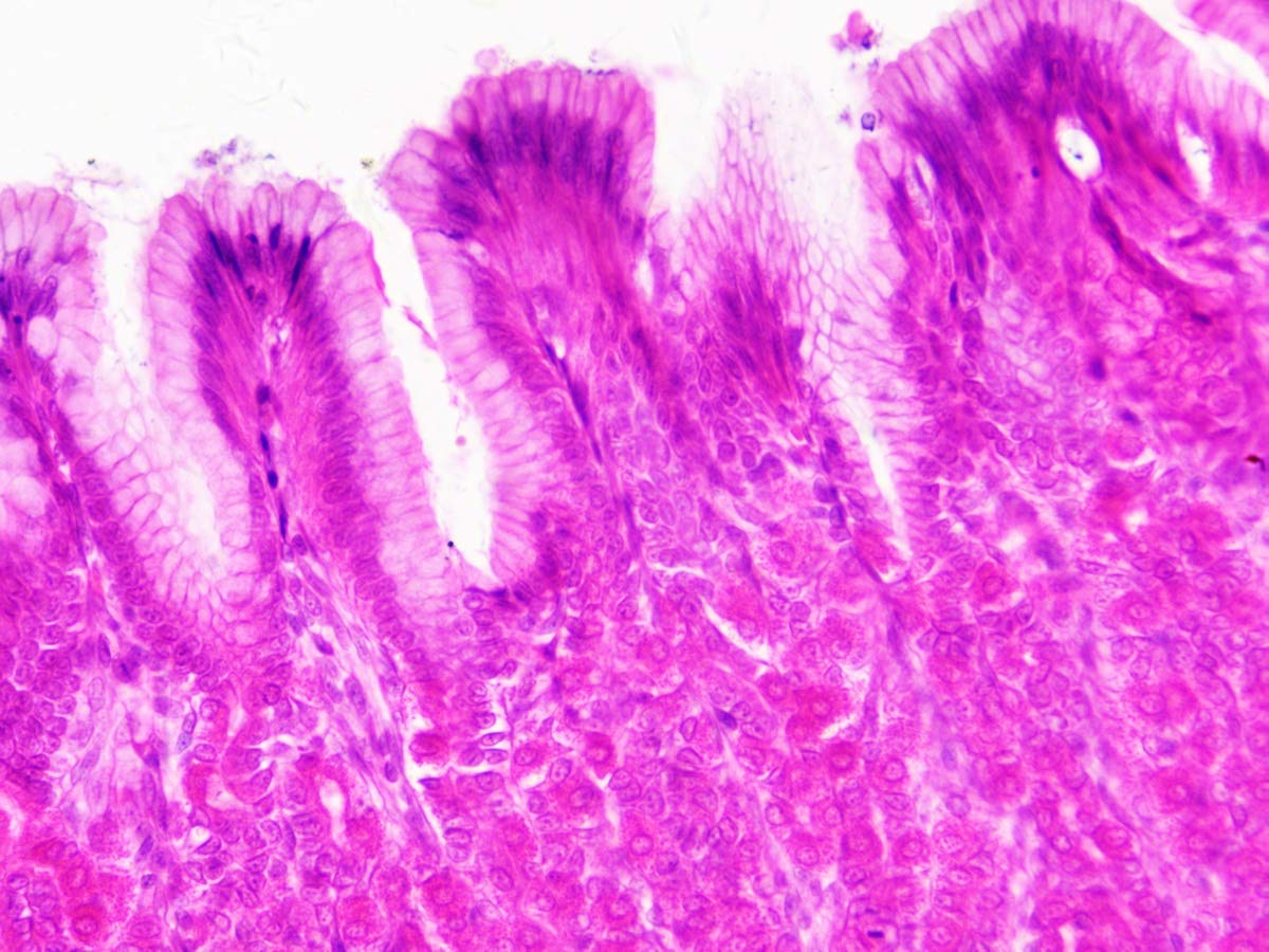 bresser-mikroskop-dauerpr-parate-30-st-ck-in-kunststoffbox-biologie-lernpr-parat image 6