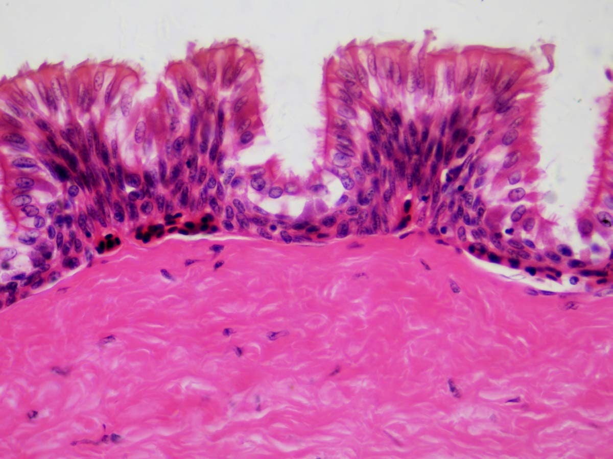 bresser-mikroskop-dauerpr-parate-30-st-ck-in-kunststoffbox-biologie-lernpr-parat image 4