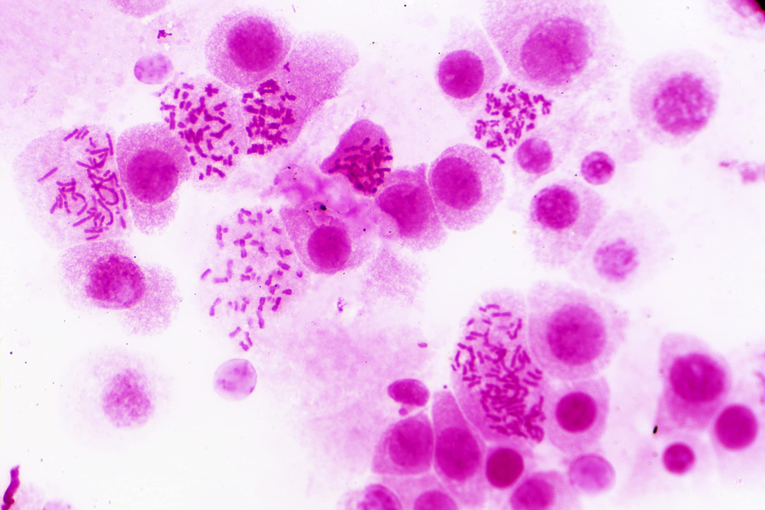 bresser-mikroskop-dauerpr-parate-30-st-ck-in-kunststoffbox-biologie-lernpr-parat image 2