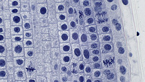 bresser-5984500-profi-dauerpr-parate-f-r-mikroskop-10-st-ck image 7