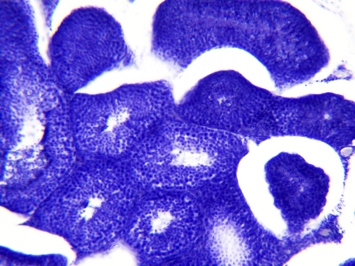 bresser-mikroskop-dauerpr-parate-30-st-ck-in-kunststoffbox-biologie-lernpr-parat image 8